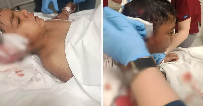 Sokak Köpekleri 8 Yaşındaki Çocuğa Saldırdı