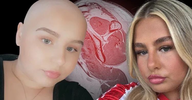 Omzundaki ağrı için doktor aylarca kas zorlanması dedi, gerçek çok sonra ortaya çıktı: Kulaklarıma inanamadım, daha 16 yaşındaydım