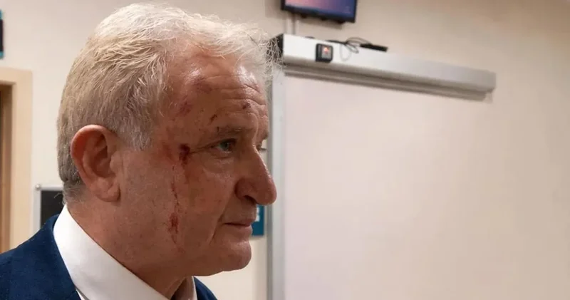 Eskişehir de gazeteciye yumruklu saldırı!