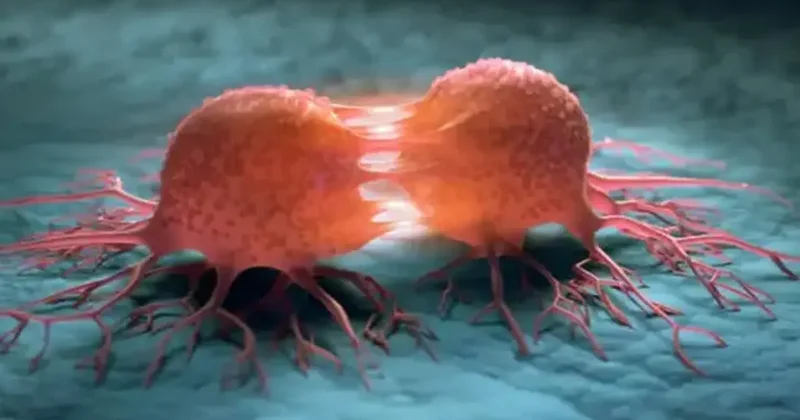 Kanser hücrelerini öldürüyor! Yeni tedavi yöntemi şaşkına çevirdi