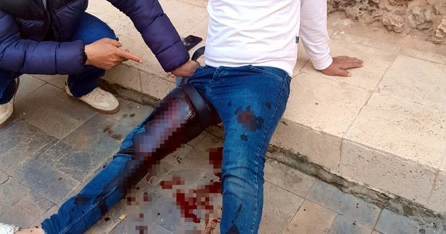 Tartıştığı butik sahibine pompalı tüfekle saldırdı: 3 yaralı Antalya Haberleri