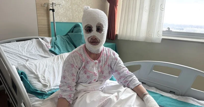 İftara hazırlık sırasında patlayan düdüklü tencere iki çocuk annesini hastanelik etti Sağlık Haberleri