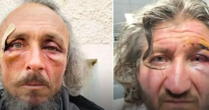 Son dakika...İsrail saldırısında yaralanan Sumud aktivistleri Türkiye’de Sözcü Gazetesi