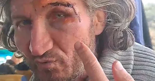 İşgal güçleri Sumud aktivisti olan Türk vatandaşı Hüseyin Oral ı darp edip parasını çaldı VİDEO İZLE