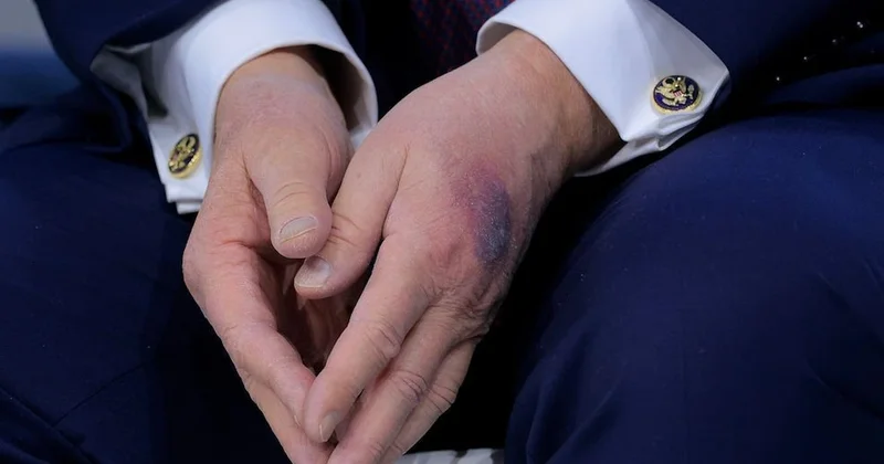 Trump ın sağlık raporu tıp dünyasını böldü: Başkan durumunu saklıyor mu? Sözcü Gazetesi
