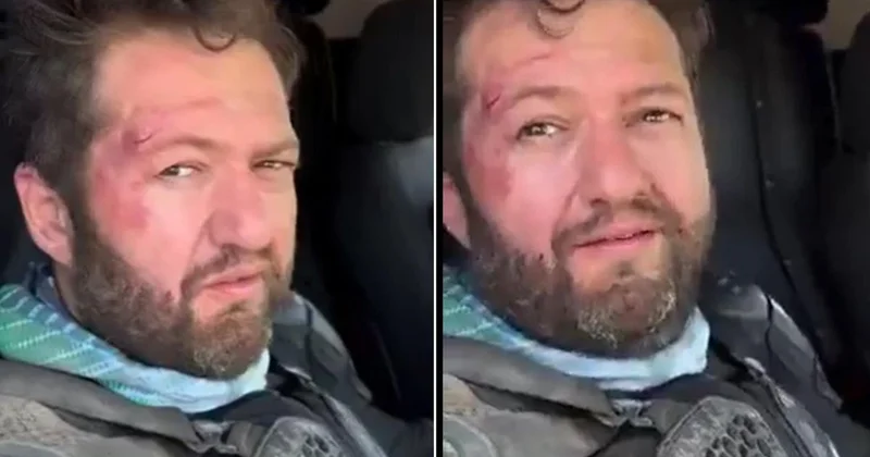 Fenomen Ömer Başdoğan motosiklet kazası geçirdi