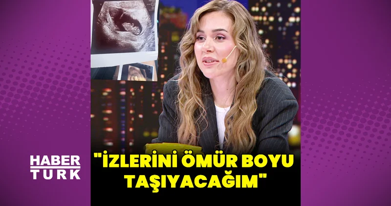 Berfu Yenenler: İzlerini ömür boyu taşıyacağım