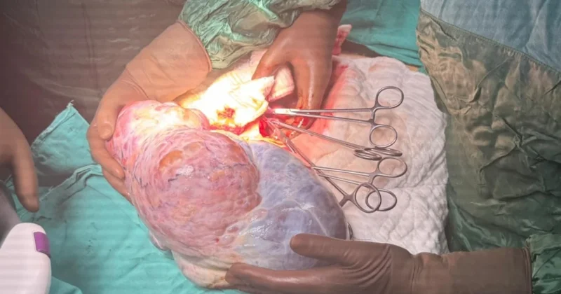 Halsizlik için gittiği hastanede hayatının şokunu yaşadı Sözcü Gazetesi