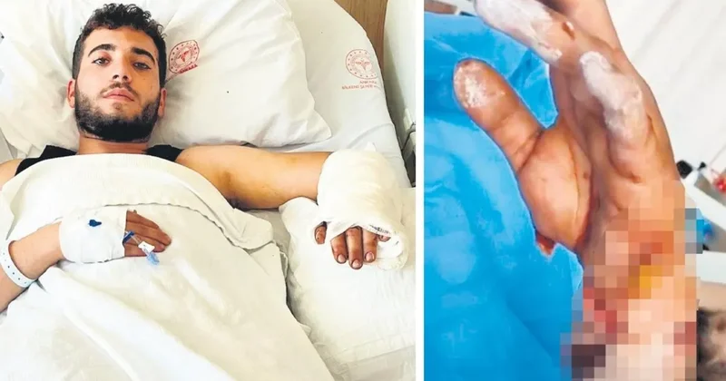 Ankara da köpek dehşeti! MS hastası genç ağır yaralandı! Kolundaki dokular ölmeye başlamış