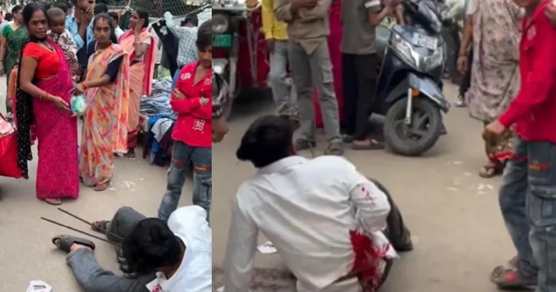 Kanlar içinde yerde kıvrandı! Görenler dehşete kapıldı! Gerçek ise bambaşka Sözcü Gazetesi