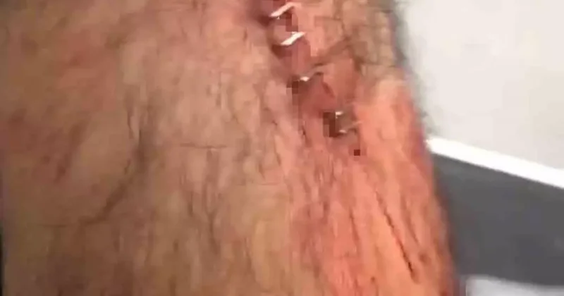 Şanlıurfa’da görev yapan öğretmene sokak ortasında jiletli saldırı