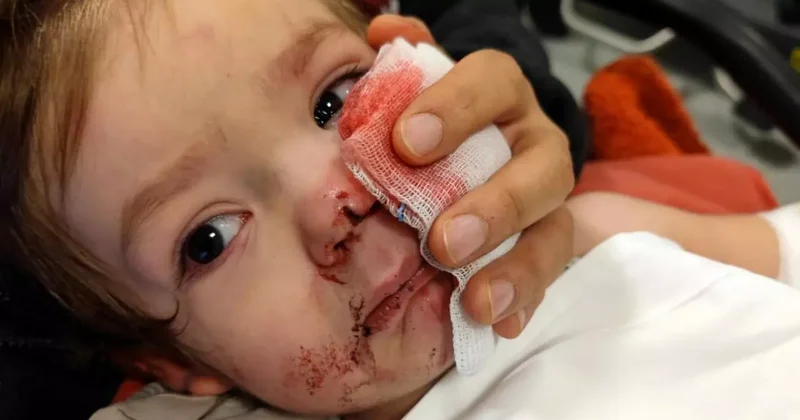 Ankara da iki kardeşe saldıran pitbull ve sahibi yakalandı