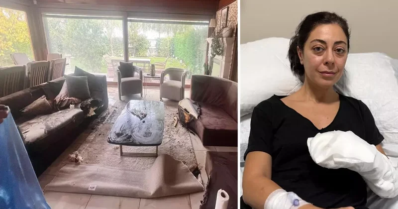 Dekoratif şömine bomba gibi patladı, vücudunun yüzde 30 u yandı