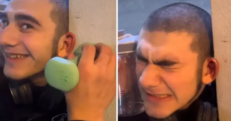 Dövüşçülere benzemek için kulak kıkırdaklarını kırdırdı