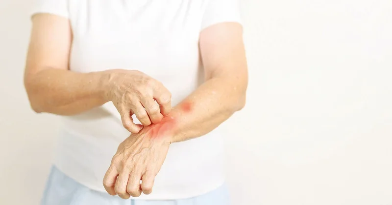 Türkiye’nin alerji haritası çıkarıldı