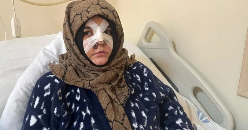 Gaziantep’de sokak ortasında öldüresiye dayak: Cani eşin yaşattıklarını böyle anlattı! ‘Taşla yüzüme defalarca…’