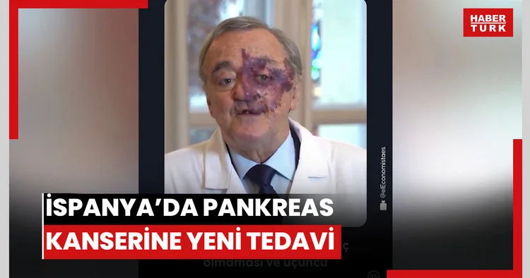 İspanya’da pankreas kanserine karşı umut veren tedavi yöntemi geliştirildi