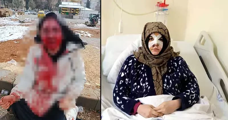 Eşinin kaldırım taşı ile dövdüğü Nazlı: Çıkarsa yarım bıraktığı işi tamamlar