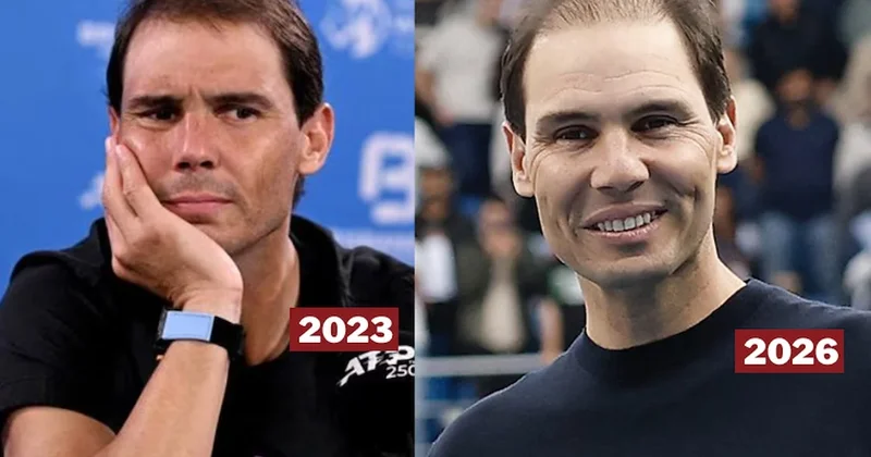 Rafael Nadal ın 3 yıl içindeki değişimi hayrete düşürdü! Hastalığı mı var? Sözcü Gazetesi