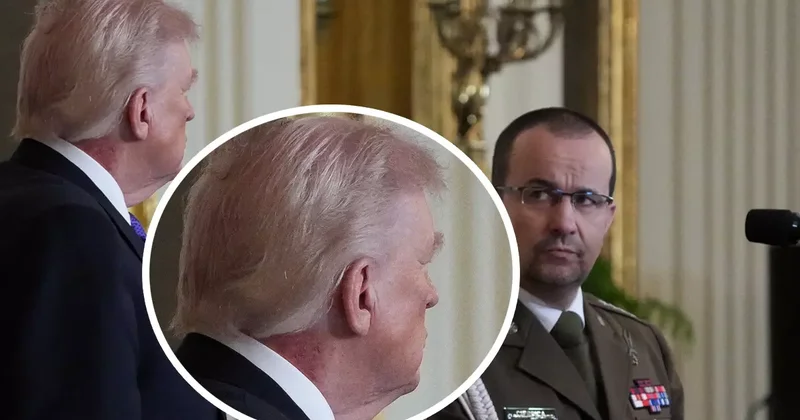 ABD Başkanı Trump ın boynundaki morluklar gündem oldu! Daha önce ellerinde olmuştu