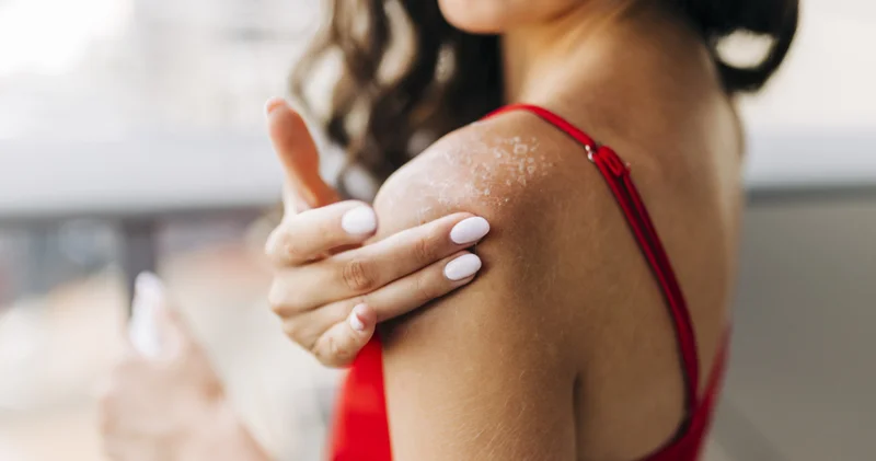 Telefonunuz neden cildinizi tanımak istiyor? iPhone’un sağlık uygulamasındaki “Fitzpatrick Cilt Tipi” sorusu ne anlama geliyor?