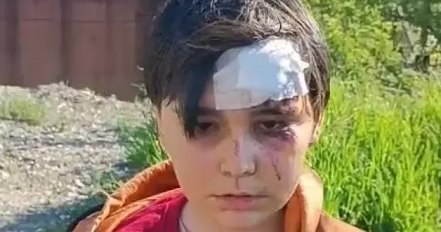 Kütahya haberleri Kütahya da başıboş köpek dehşeti! 2 çocuk saldırıya uğradı 02 Mayıs 2026