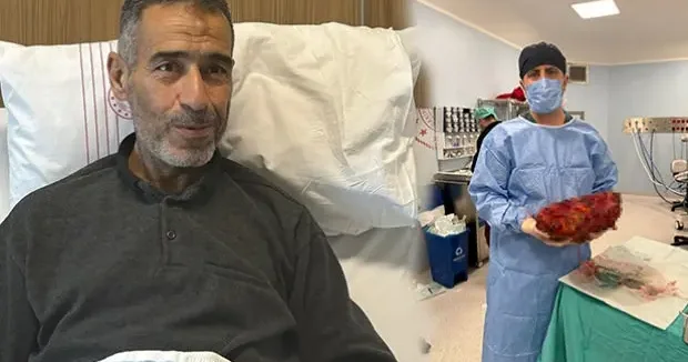 Gaziantep haberleri Gaziantep te 61 yaşındaki adamın 8 kilogramlık böbreği alındı 02 Mayıs 2026