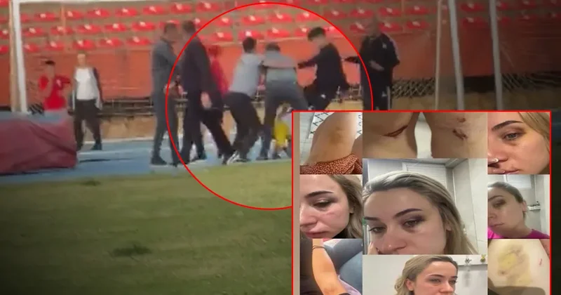 Zonguldak ta eski eşe tekme tokat dayak: Elif öğretmenin sosyal medya paylaşımları yürek burkmuştu! Abisi ve arkadaşları...