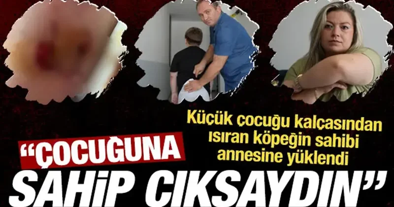 Küçük çocuğu kalçasından ısıran köpeğin sahibi anneye yüklendi: Çocuğuna sahip çıksaydın