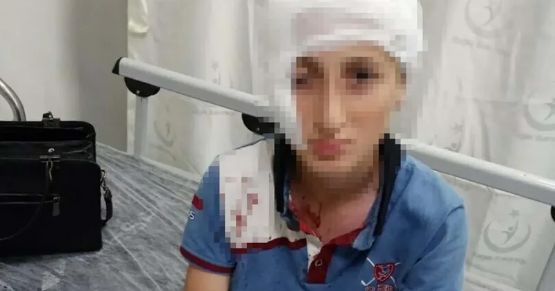 İzmir de köpek saldırısına uğrayan 11 yaşındaki çocuğa emsal niteliğinde tazminat