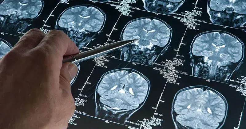 Araştırma: Derin uyku Alzheimer’ı yavaşlatıyor