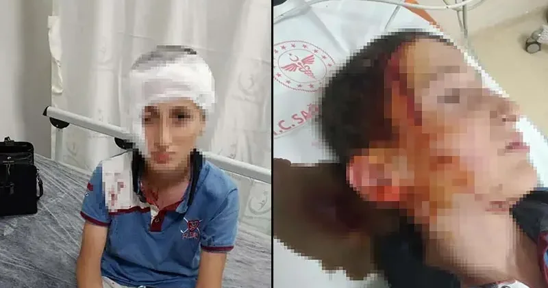 11 yaşındaki çocuğa köpek saldırısında 1,2 milyon TL tazminat kararı
