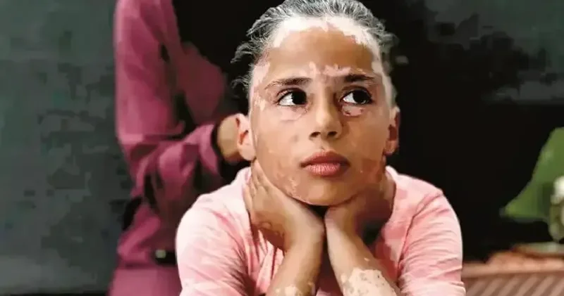 Gazzeli çocukların travması bitmedi Ortadoğu Haberleri