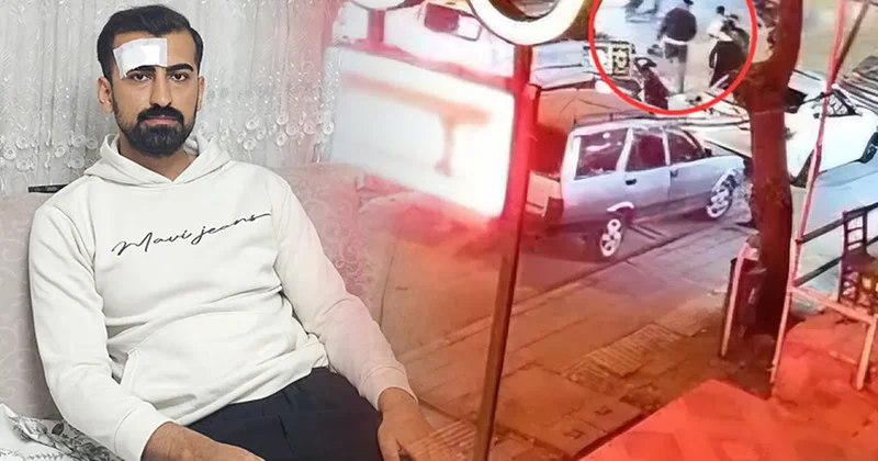 SON DAKİKA... Yer Adana! Yol verme kavgasında motokuryeyi yüzünden, bacağından ve kalçasından bıçakladılar: Dehşet anları kamerada!