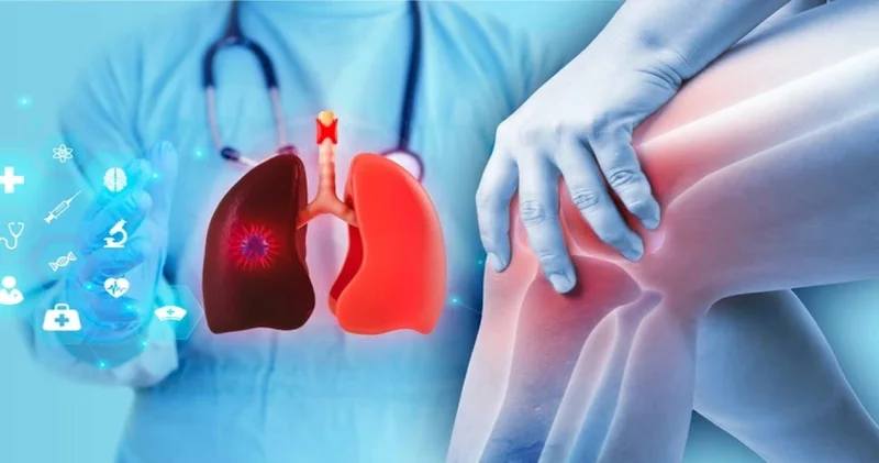Diz ve omuzdaki ağrı akciğerlerinizin çığlığı olabilir
