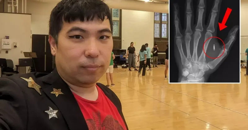 Akılalmaz hata! Eline yerleşltirdiği mikroçipin şifresini unuttu