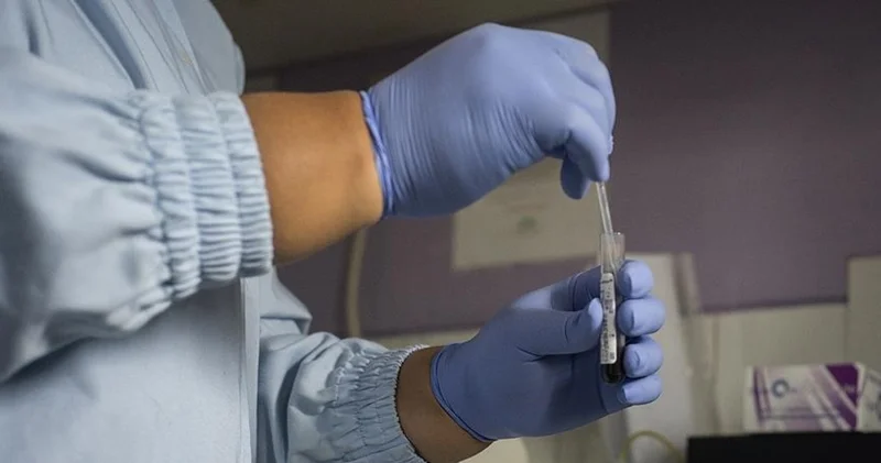 DSÖ: 2024 te 1.3 milyon kişi AIDS hastalığına yakalandı Sağlık Haberleri