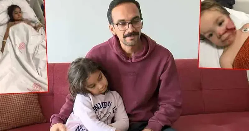 2 kardeşe saldıran pitbull ile ilgili 12 şikayet yapılmış