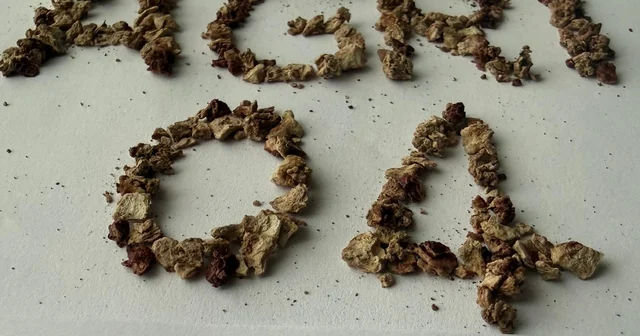 Ağrı da zorlu taş cerrahisi başarıyla gerçekleştirildi Ağrı Haberleri