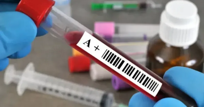 A Rh+ kan grubuna sahip olanları ilgilendiriyor: Yorgun hissetmenizin sebebi ve çaresi buymuş Sözcü Gazetesi