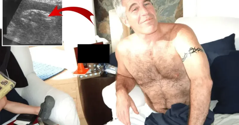 Epstein ın gizli çocukları var mı? Ultrason görüntüsü de dosyadan çıktı