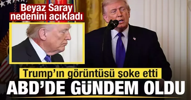 Trump ın görüntüsü şoke etti! ABD de gündem oldu! Beyaz Saray nedenini açıkladı