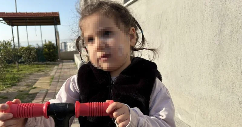 İzmir de köpek dehşeti: 3 yaşındaki Ada nın yüzü pençe ve ısırıkla dolu