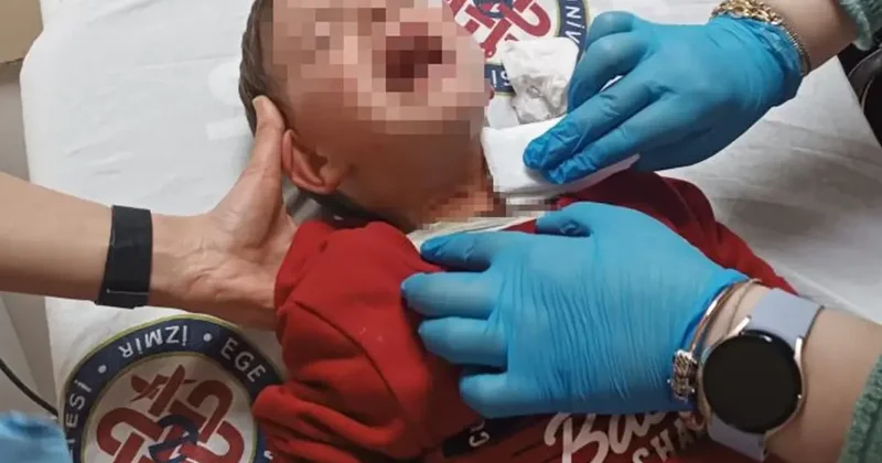 2 Yaşındaki Çocuğa Bıçaklı Saldırı