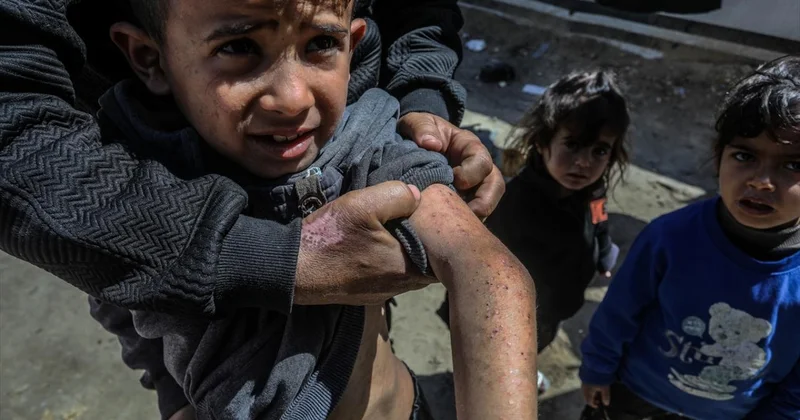 Filistin Sağlık Bakanlığından Gazze de salgın hastalık uyarısı