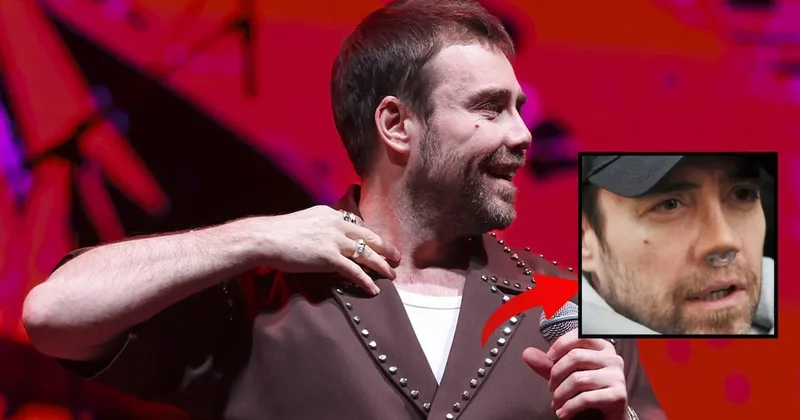 Burun ameliyatı sonrası sahnelere geri döndü; Murat Dalkılıç ın son haline yorum yağdı Sözcü Gazetesi