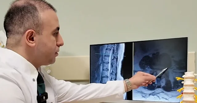 Uzmanından bel fıtığına karşı uyarı: Ameliyat en son seçenek ama bu belirtilere dikkat VİDEO İZLE
