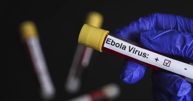 Nijerya, Ebola tehdidi nedeniyle 10 eyaleti alarm durumuna geçirdi