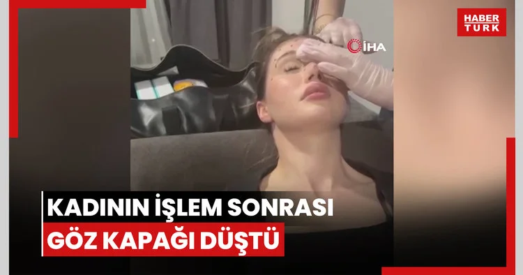 Zeytinburnu’nda botoks yaptıran kadının işlem sonrası göz kapağı düştü