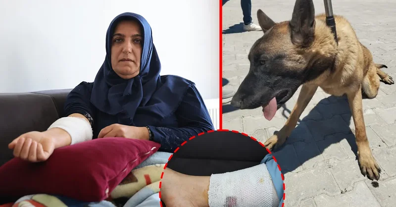 Kızını yolcu etmek isterken köpek saldırısına uğradı! Talihsiz kadın kabus dakikalarını anlattı: Beni paramparça edecekti!